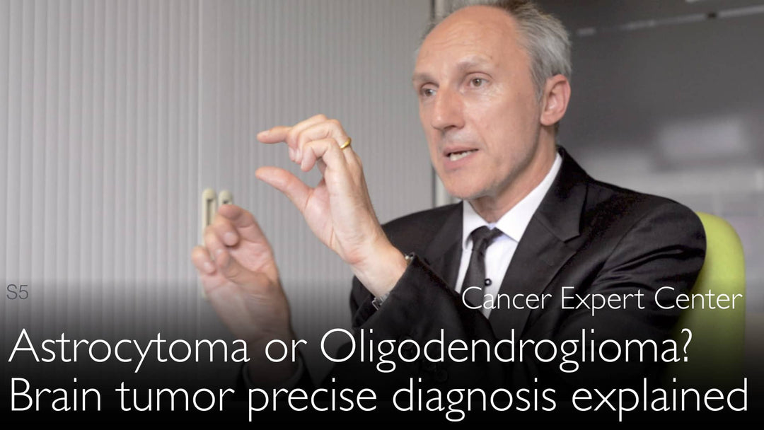 Astrocitoma o Oligodendroglioma? Diagnosi precisa dei tumori cerebrali. 4