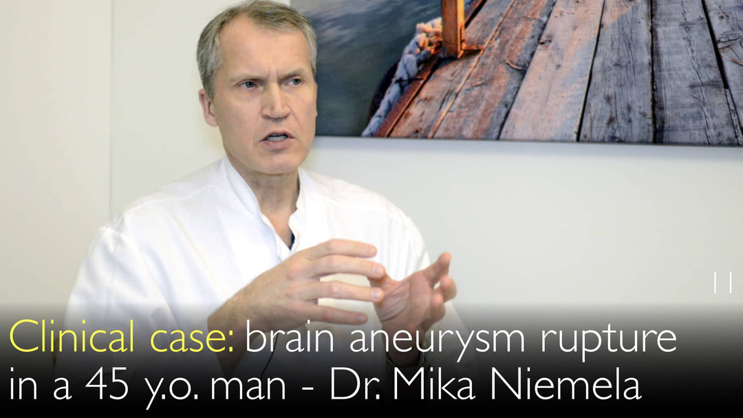 Rottura di aneurisma cerebrale in un uomo di 45 anni. Caso clinico. 11