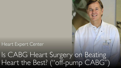 Chirurgia di bypass aorto-coronarico su cuore battente. CABG senza circolazione extracorporea (CABG off-pump). 4