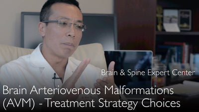 Trattamento della malformazione artero-venosa cerebrale. Terapia della malformazione artero-venosa. 9