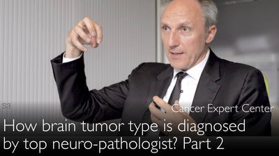 Come diagnosticare il tipo di tumore cerebrale? Lo spiega un esperto di neuro-oncologia. Parte 2. 2