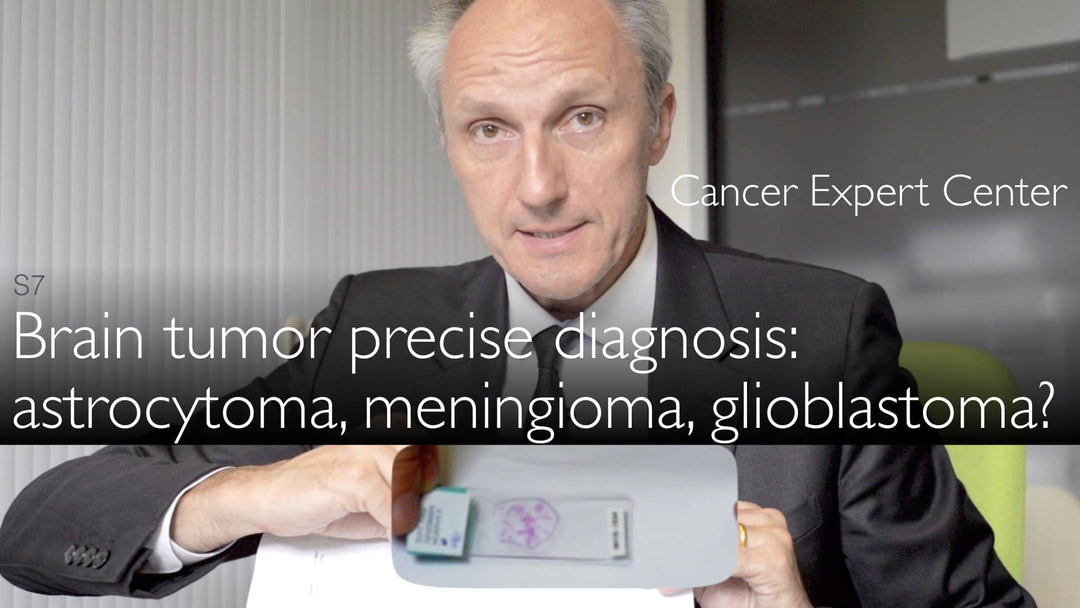 Diagnosi precisa dei tumori cerebrali. Meningioma, astrocitoma, glioblastoma. 6
