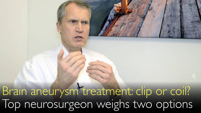 Trattamento dell'aneurisma cerebrale. Clip, spirale o stent? Come scegliere la terapia migliore per l'aneurisma intracranico? 4