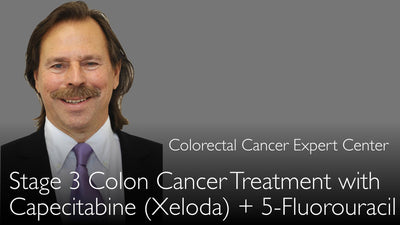 Trattamento del carcinoma del colon in stadio 3. Capecitabina (Xeloda) e 5-fluorouracile (5-FU). 5-1