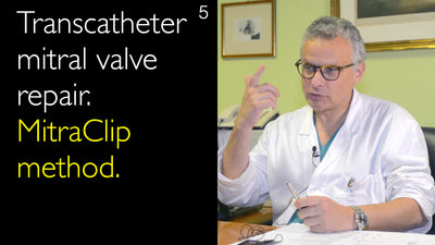 Riparazione transcatetere della valvola mitrale. Metodo MitraClip. 5