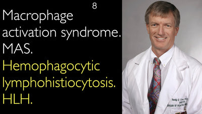 Sindrome da attivazione macrofagica. MAS. Linfoistiocitosi emofagocitica. HLH. 8