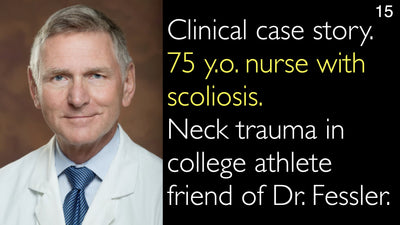 Caso clinico. Infermiera di 75 anni con scoliosi. Trauma cervicale in un amico atleta universitario del Dr. Fessler. 15