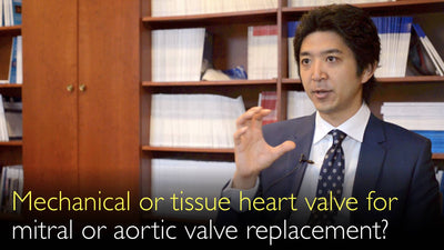 Valvola cardiaca meccanica o biologica per la sostituzione della valvola mitrale o aortica? Valvola cardiaca stentata o senza stent?