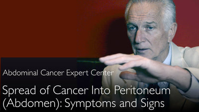 Sintomi del carcinoma peritoneale metastatico. Il segno principale è l'addome in espansione. 3