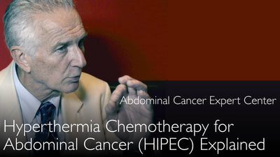 Ipertermia Chemioterapica per il Carcinoma Peritoneale. Perché applicare il calore? Chemioterapia Intraperitoneale Ipertermica (CIIP). 6