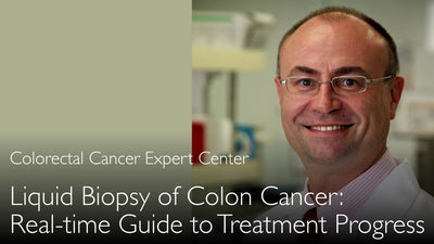 Biopsia liquida del carcinoma del colon. Come monitorare continuamente il trattamento oncologico. 5