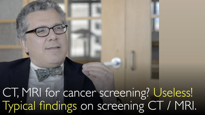 TC e RM per lo screening oncologico. Inutili! Quali sono i reperti tipici in una TC total body? Un eminente radiologo spiega.